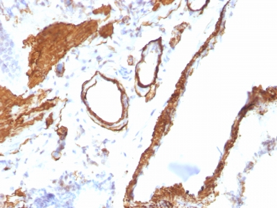 Formalin-fixed, paraffin embedded rat lung sections stained with 100 ul anti-Smooth Muscle Actin (clone ACTA2/791) at 1:200. HIER epitope retrieval prior to staining was performed in 10mM Citrate, pH 6.0.